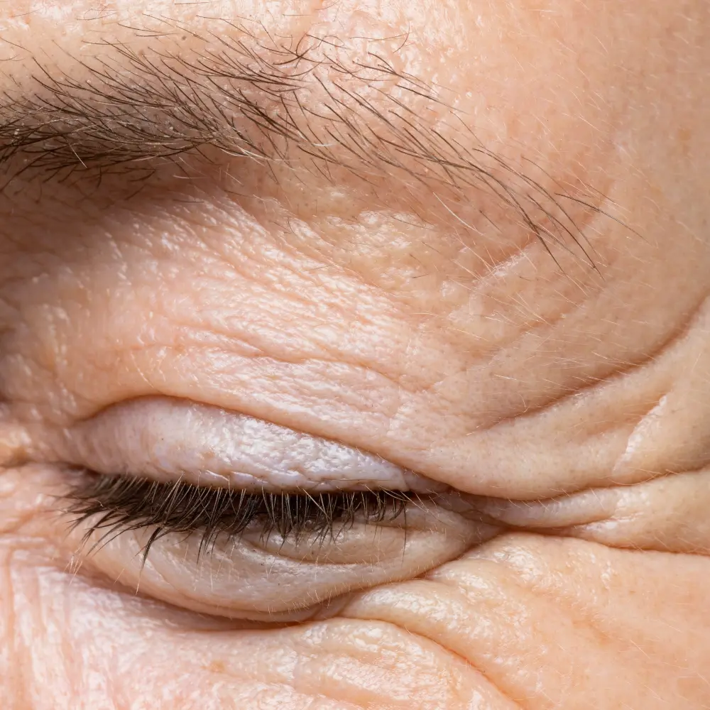 Collagen loss in midlife