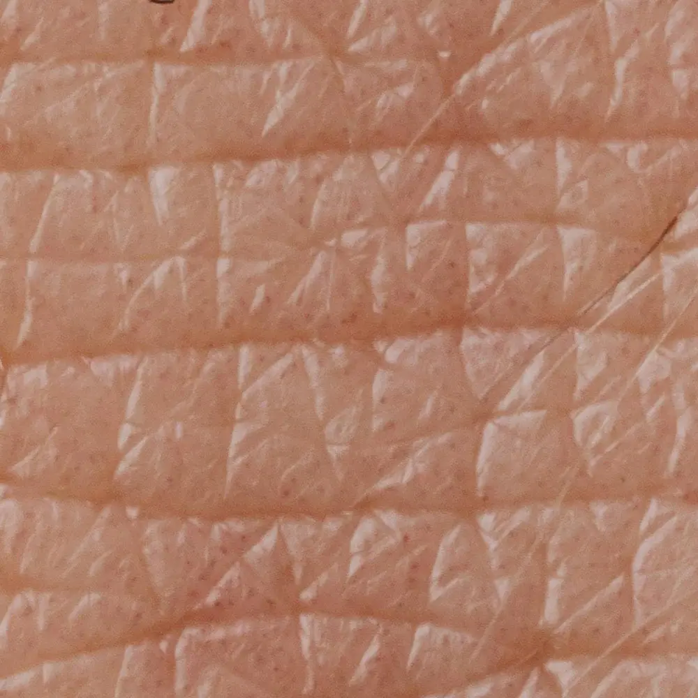 Skin becomes drier and less elastic during perimenopause