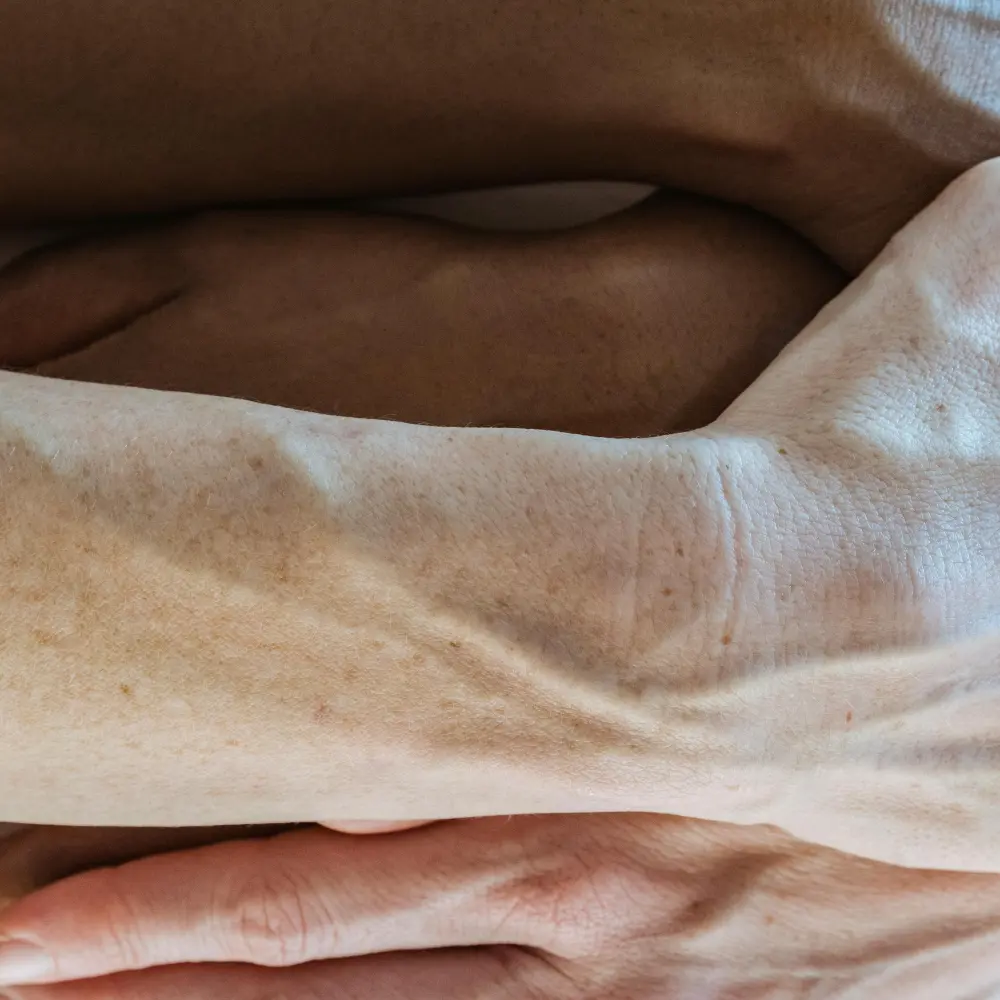 Why skin changes during perimenopause